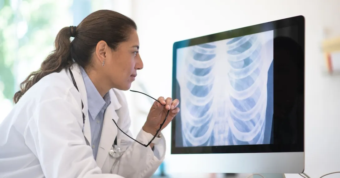 A doctor assessing a chest X-ray scan
A doctor assessing a chest X-ray scan